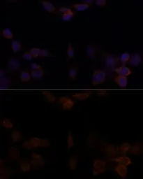 Anti-YAP1 antibody used in Immunocytochemistry/ Immunofluorescence (ICC/IF). GTX64336