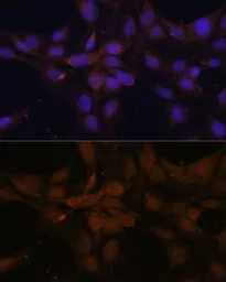 Anti-YAP1 antibody used in Immunocytochemistry/ Immunofluorescence (ICC/IF). GTX64336