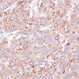 Anti-YAP1 antibody used in IHC (Paraffin sections) (IHC-P). GTX64336