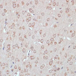 Anti-YAP1 antibody used in IHC (Paraffin sections) (IHC-P). GTX64336