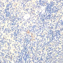 Anti-FOXP3 antibody used in IHC (Paraffin sections) (IHC-P). GTX64343