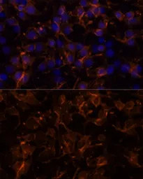 Anti-NCAM antibody used in Immunocytochemistry/ Immunofluorescence (ICC/IF). GTX64346