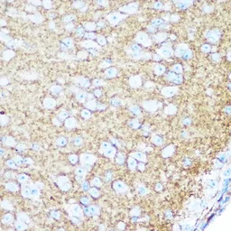 Anti-NCAM antibody used in IHC (Paraffin sections) (IHC-P). GTX64346