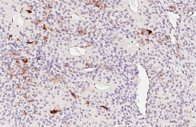 Anti-ACTH antibody [GT195] used in IHC (Paraffin sections) (IHC-P). GTX643472