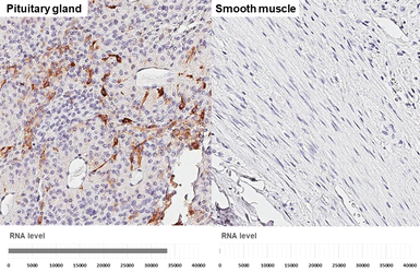 Anti-ACTH antibody [GT195] used in IHC (Paraffin sections) (IHC-P). GTX643472