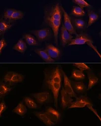 Anti-Osteocalcin antibody used in Immunocytochemistry/ Immunofluorescence (ICC/IF). GTX64348