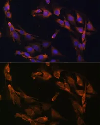 Anti-Osteocalcin antibody used in Immunocytochemistry/ Immunofluorescence (ICC/IF). GTX64348