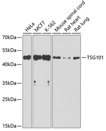 Anti-TSG101 antibody used in Western Blot (WB). GTX64349
