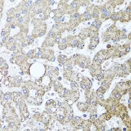 Anti-TSG101 antibody used in IHC (Paraffin sections) (IHC-P). GTX64349
