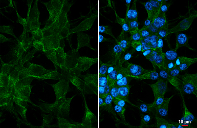 Anti-FPR1 antibody [HL4262] used in Immunocytochemistry/ Immunofluorescence (ICC/IF). GTX643498