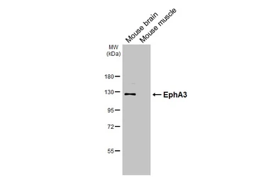 Anti-EphA3 antibody [HL4264] used in Western Blot (WB). GTX643500