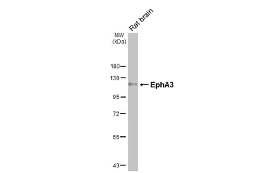 Anti-EphA3 antibody [HL4264] used in Western Blot (WB). GTX643500