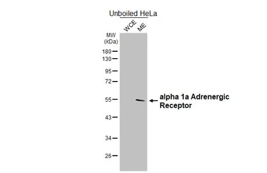 Anti-alpha 1a Adrenergic Receptor antibody [HL4266] used in Western Blot (WB). GTX643502
