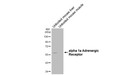 Anti-alpha 1a Adrenergic Receptor antibody [HL4267] used in Western Blot (WB). GTX643503