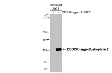 Anti-Latrophilin 2 antibody [HL4270] used in Western Blot (WB). GTX643506