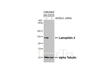 Anti-Latrophilin 2 antibody [HL4270] used in Western Blot (WB). GTX643506