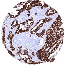 Anti-pan Cytokeratin antibody [HMV4276] HistoMAX&trade; used in IHC (Paraffin sections) (IHC-P). GTX643512