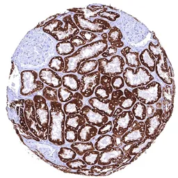 Anti-pan Cytokeratin antibody [HMV4276] HistoMAX&trade; used in IHC (Paraffin sections) (IHC-P). GTX643512