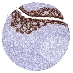 Anti-pan Cytokeratin antibody [HMV4276] HistoMAX&trade; used in IHC (Paraffin sections) (IHC-P). GTX643512