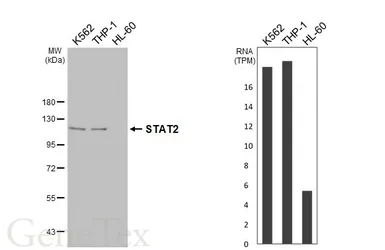 Anti-STAT2 antibody [HL4277] used in Western Blot (WB). GTX643517