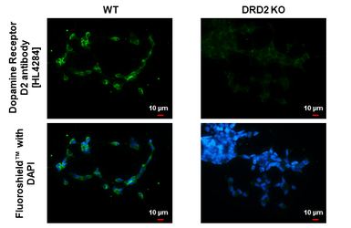 Anti-Dopamine Receptor D2 antibody [HL4284] used in Immunocytochemistry/ Immunofluorescence (ICC/IF). GTX643524