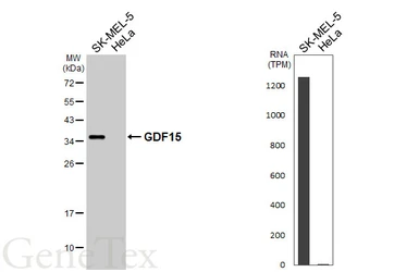 Anti-GDF15 antibody [HL4287] used in Western Blot (WB). GTX643527