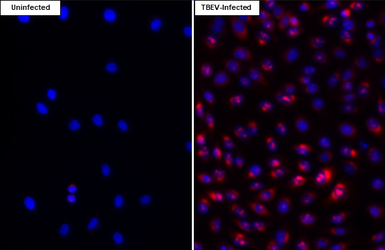 Anti-Tick-borne encephalitis virus (TBEV) Capsid antibody [HL4289] used in Immunocytochemistry/ Immunofluorescence (ICC/IF). GTX643529
