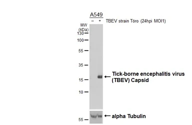Anti-Tick-borne encephalitis virus (TBEV) Capsid antibody [HL4289] used in Western Blot (WB). GTX643529