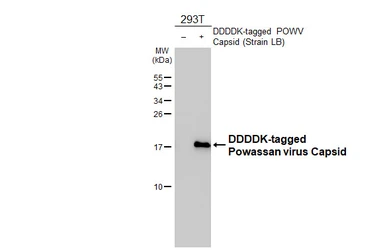 Anti-Powassan virus Capsid antibody [HL4303] used in Western Blot (WB). GTX643543