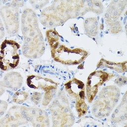 Anti-BMP2 antibody used in IHC (Paraffin sections) (IHC-P). GTX64355