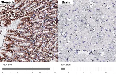 Anti-GPR30 antibody [HL4305] used in IHC (Paraffin sections) (IHC-P). GTX643552