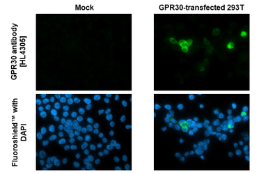 Anti-GPR30 antibody [HL4305] used in Immunocytochemistry/ Immunofluorescence (ICC/IF). GTX643552