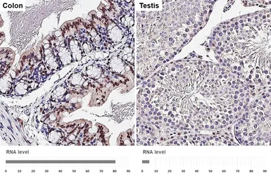 Anti-ERR alpha antibody [HL4307] used in IHC (Paraffin sections) (IHC-P). GTX643554