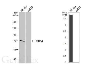 Anti-PAD4 antibody [HL4309] used in Western Blot (WB). GTX643556