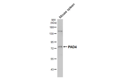 Anti-PAD4 antibody [HL4309] used in Western Blot (WB). GTX643556