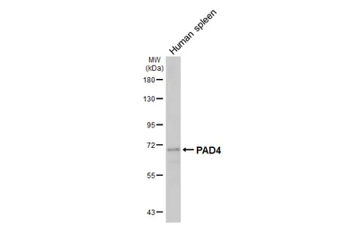 Anti-PAD4 antibody [HL4309] used in Western Blot (WB). GTX643556