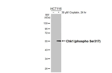 Anti-Chk1 (phospho Ser317) antibody [HL4313] used in Western Blot (WB). GTX643560