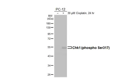 Anti-Chk1 (phospho Ser317) antibody [HL4313] used in Western Blot (WB). GTX643560