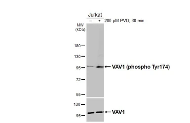 Anti-VAV1 (phospho Tyr174) antibody [HL4315] used in Western Blot (WB). GTX643562
