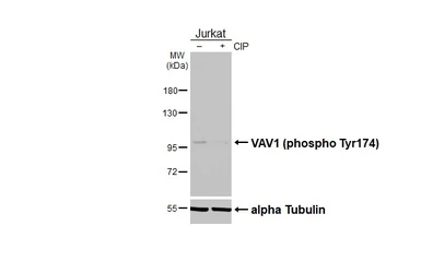 Anti-VAV1 (phospho Tyr174) antibody [HL4315] used in Western Blot (WB). GTX643562