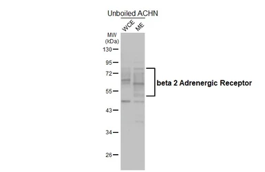 Anti-beta 2 Adrenergic Receptor antibody [HL4320] used in Western Blot (WB). GTX643567