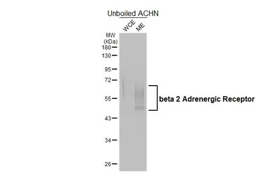 Anti-beta 2 Adrenergic Receptor antibody [HL4320] used in Western Blot (WB). GTX643567
