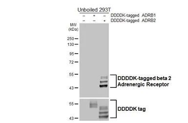 Anti-beta 2 Adrenergic Receptor antibody [HL4320] used in Western Blot (WB). GTX643567