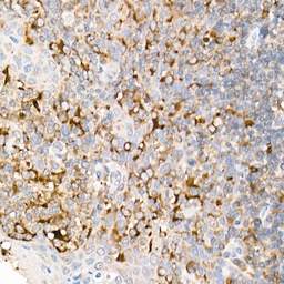 Anti-Fas Ligand antibody used in IHC (Paraffin sections) (IHC-P). GTX64357