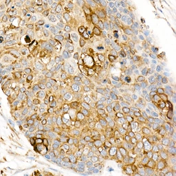 Anti-Fas Ligand antibody used in IHC (Paraffin sections) (IHC-P). GTX64357