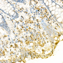 Anti-Fas Ligand antibody used in IHC (Paraffin sections) (IHC-P). GTX64357