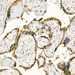Anti-Fas Ligand antibody used in IHC (Paraffin sections) (IHC-P). GTX64357
