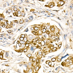Anti-Fas Ligand antibody used in IHC (Paraffin sections) (IHC-P). GTX64357