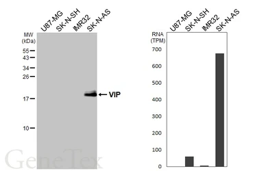 Anti-VIP antibody [HL4332] used in Western Blot (WB). GTX643579