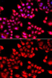 Anti-Ku70 antibody used in Immunocytochemistry/ Immunofluorescence (ICC/IF). GTX64359